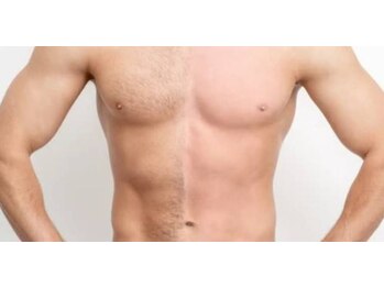 ディライト 名古屋駅店(Delight)/メンズ脱毛　ボディ全身脱毛