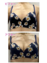 バーディー(BIRDIE)/施術１回/3０代