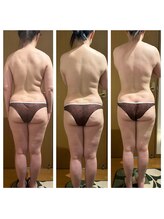 スリーアール(three R)/5回コース　ビフォーアフター