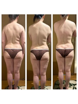 スリーアール(three R)/◆コース ビフォーアフター◆