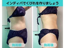 ナナ 銀座(Nana)/くびれ作りたい方へおすすめ