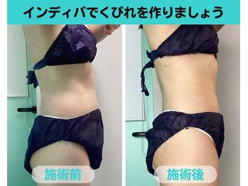 ナナ 銀座(Nana)/くびれ作りたい方へおすすめ