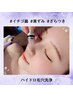 鼻集中!【黒ずみ/角栓/産毛】ハイドロ吸引×wax脱毛×超音波洗浄★60分6000円