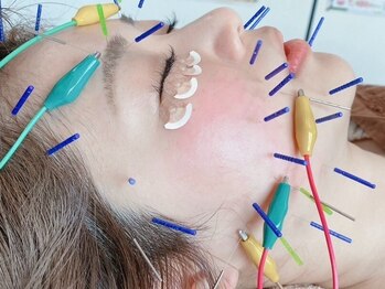 レフア 上北沢整体院の写真/<整体×美容鍼>顔・身体の歪み/たるみをWケア♪姿勢・不調に根本アプロ-チで代謝促進★ ストレッチ×矯正◎