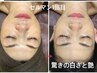 【韓国エステセルマン】ダウンタイム無しでつるつる肌に！　¥22000→¥11000