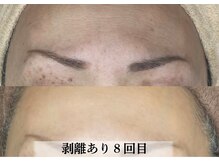 ラビエス(LAVIES)/【50代】小じわで老け顔に