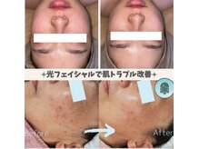 アールビューティ(R beauty)の雰囲気（光フェイシャルで肌トラブル改善!シミ、シワ、ニキビ、たるみ）