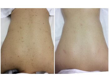 ミーフォレスト(Mi Forest)/