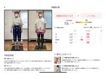 ティーシー(TC)/1月前と今、姿勢変化(正面) 評価