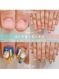 深爪さんでも楽しめるネイル。