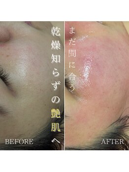 ベレア(BELEA)/乾燥知らずになる♪