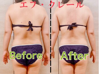 エフクレール(Ef Clair)/スロータス施術ビフォーアフター
