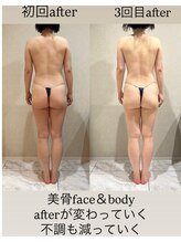 シェリーナ(cherieNa)/月１ケアで変わっていく体