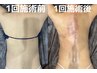 超脂肪分解【全身デトックスカッピングスライドマッサージ】¥27500→¥15800