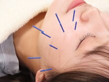 いまはやし鍼灸整体院 香椎和白店/