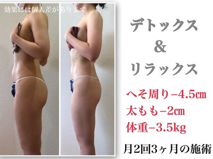 カロン(Kalon)の写真