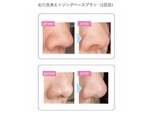 ニコ(nico)/毛穴洗浄エイジングベースプラン