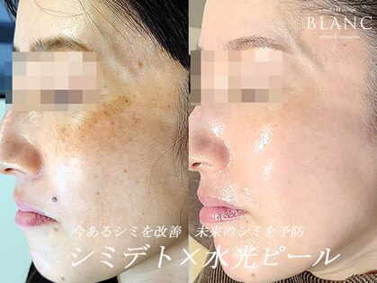 ブラン(BLANC)の写真