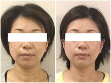 美容整体ウェリナ あま甚目寺院/小顔矯正/骨盤矯正/美脚サロン