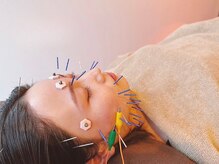 渋谷α鍼灸院の雰囲気(国家資格保持者の確かな技×個室空間♪)