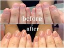 劇 的☆深爪改善!before→after