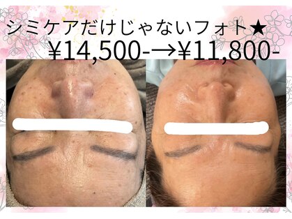 サロンツキ(salon tuki)の写真
