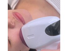 ディライト 名古屋駅店(Delight)/顔脱毛で毛穴ケア