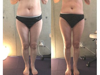 サプナジー(Suppnrgy)/カスタムトリートメント