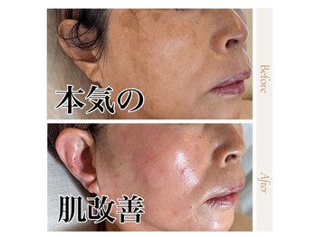 ラグランシエル(Le grand ciel)