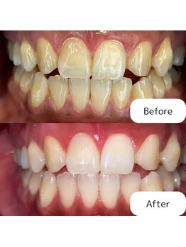 リ ホワイト(Re.White)/