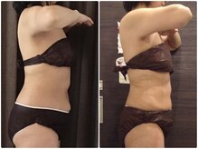 美容整体ウェリナ 名駅院/小顔矯正/骨盤矯正/美脚サロン