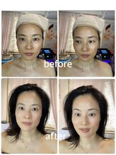レイ(Lei)/当店のビフォーアフター