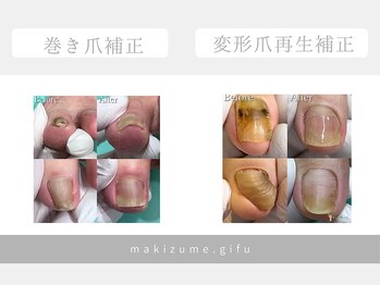 巻き爪補正店 金山店