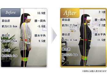 カラダボ(Kaladabo.)/1カ月の変化。首の角度に注目！