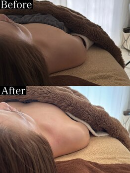 リセルフ(Liself)/巻肩・肩こり・首こりのケアに◎