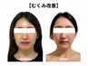 【むくみ・ほうれい線】眠れるほど優しいオールハンドで骨格から小顔へ★