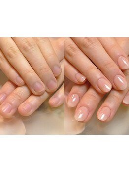 爪の悩みを解消できる（ケア含む）