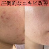 リラ(RELLER)