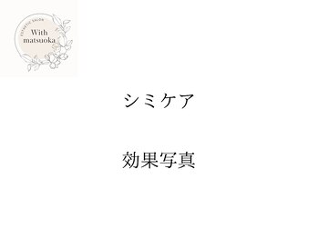 ウィズマツオカ 光の森店/シミケア効果写真
