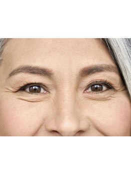 ホウレイ線・たるみ改善！予防ケア