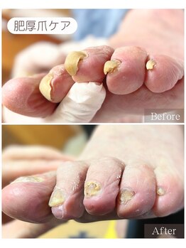ドクターネイル爪革命 THE KANAZAWA 御経塚/肥厚爪ケア