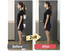 ルーツ 北山田店(Roots)の雰囲気(姿勢が整い、長年の悩みの肩こりと頭痛が無くなりました)