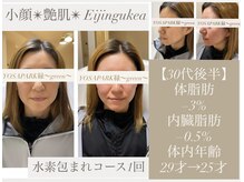 ヨサパーク グリーン(YOSA PARK 緑 green)の雰囲気（ハーブミストに包まれて全身潤いと発汗！癒し/デトックス/痩身）