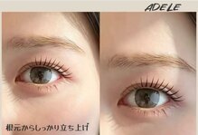 アデル(ADELE)