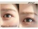 アデル(ADELE)の写真
