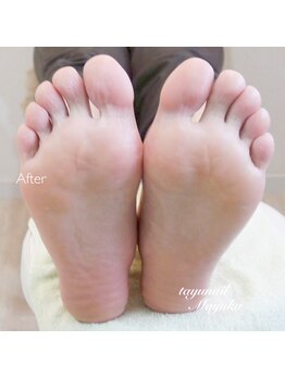 たゆ ネイル(たゆnail)の写真/【半額4,400円*】選べる贅沢なアロマバス*トリートメントで叶える！すっきり角質ケアでつるつる足裏体験♪