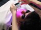 バイアール 新宿メンズ店(byR)の写真/【新宿駅周辺】男性も肌ケアの時代★光フェイシャル＆ピーリングで毛穴/肌荒れを徹底ケア