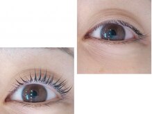 グローアイプラス(glow eye+)