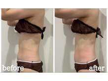 ファビリス 仙台ロフト店(FAVILIS)/【痩身】キャビリポ40分1回