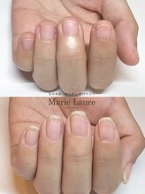 マリーロール 梅田店(Marie Laure)/自爪育成/深爪矯正/ネイルケア